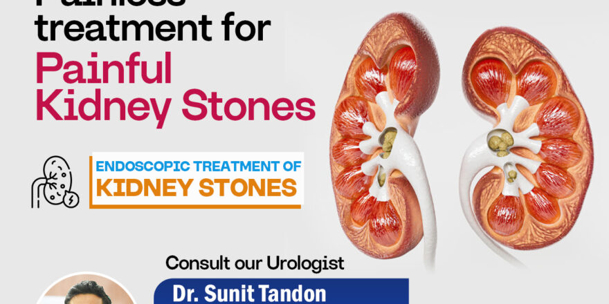 Kidney Stones